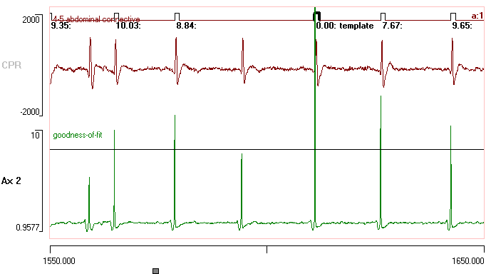 Goodness-of-fit in template recognition